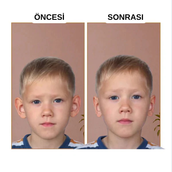 Klinikevin Kepçe Kulak Bandı