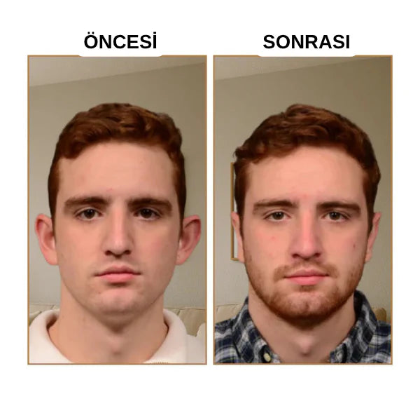 Klinikevin Kepçe Kulak Bandı