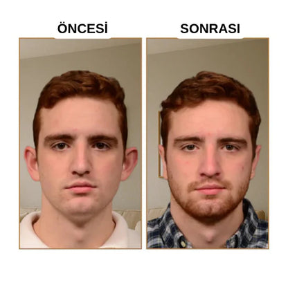 Klinikevin Kepçe Kulak Bandı