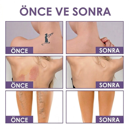 KlinikEvin DermaCover Ultra (Kalıcı Vücut Kapatıcısı & Pürüzsüzleştirici Efekt)