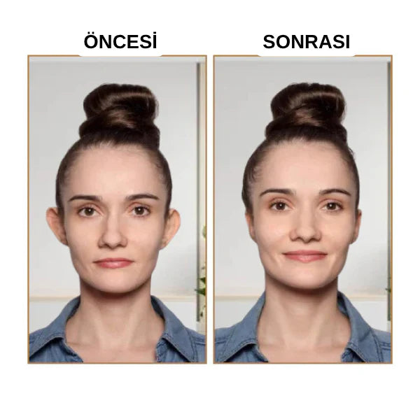 Klinikevin Kepçe Kulak Bandı