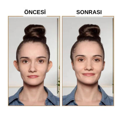 Klinikevin Kepçe Kulak Bandı