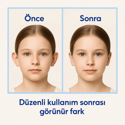 Klinikevin Kepçe Kulak Bandı