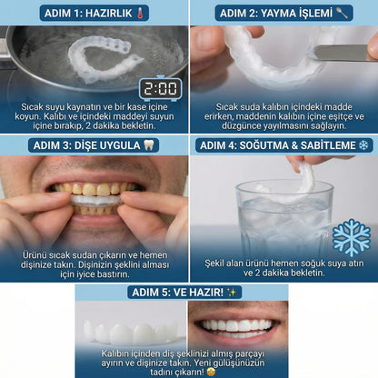 KlinikEvin™ SmileForm Profil Diş Estetik Seti ( Alt Üst Set )